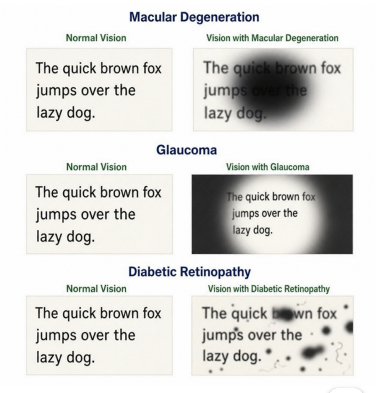 Side by side comparisons of how a sentence of text is made difficult to read for people with macular degeneration, glaucoma, and diabetic retinopathy. People with macular degeneration see the center of the text obscured. They can only see around the edges. With glaucoma, it's the opposite. They can see the center, but not the edges. For diabetic retinopathy there are obstructed spots scattered at random across the text. In all cases, they can not see every letter or word of the text.